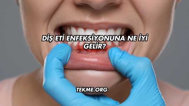 Diş Eti Enfeksiyonuna Ne İyi Gelir?