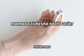 Parmak Ezilmesine Ne İyi Gelir?