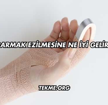 Parmak Ezilmesine Ne İyi Gelir?