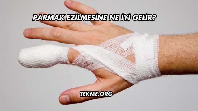 Parmak Ezilmesine Ne İyi Gelir?