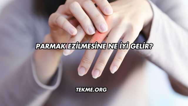 Parmak Ezilmesine Ne İyi Gelir?