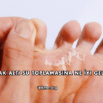 Ayak Altı Su Toplamasına Ne İyi Gelir?