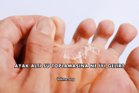 Ayak Altı Su Toplamasına Ne İyi Gelir?