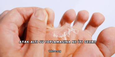 Ayak Altı Su Toplamasına Ne İyi Gelir?