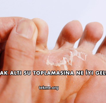 Ayak Altı Su Toplamasına Ne İyi Gelir?