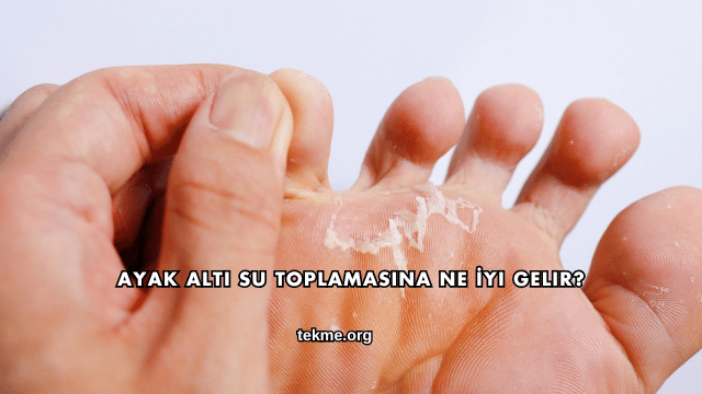 Ayak Altı Su Toplamasına Ne İyi Gelir?