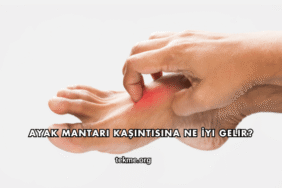Ayak Mantarı Kaşıntısına Ne İyi Gelir?