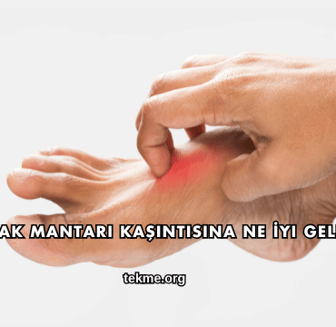 Ayak Mantarı Kaşıntısına Ne İyi Gelir?