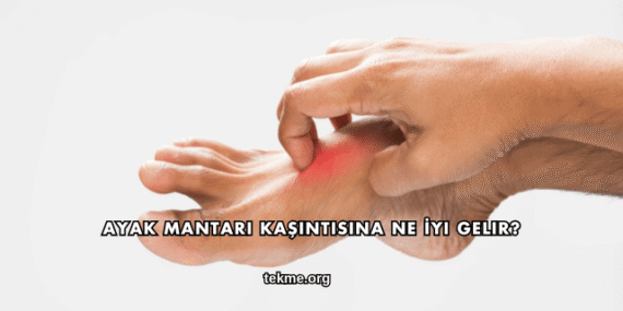Ayak Mantarı Kaşıntısına Ne İyi Gelir?