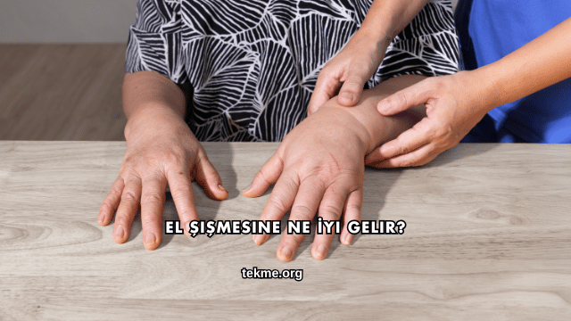 El Şişmesine Ne İyi Gelir?