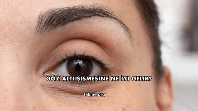 Göz Altı Şişmesine Ne İyi Gelir?