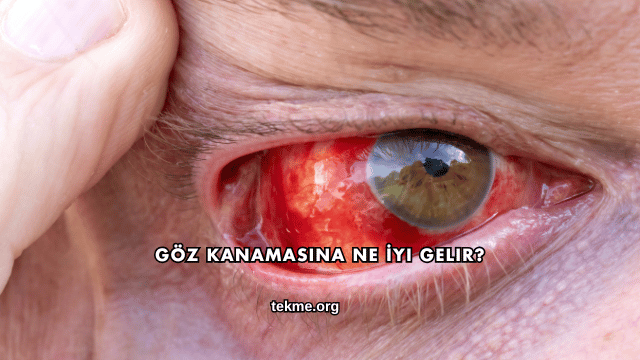 Göz Kanamasına Ne İyi Gelir?