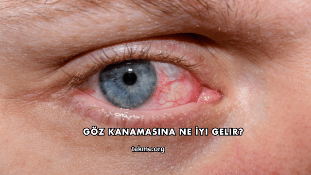 Göz Kanamasına Ne İyi Gelir?