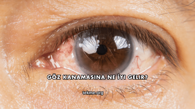 Göz Kanamasına Ne İyi Gelir?