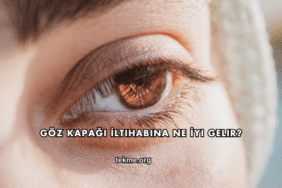 Göz Kapağı İltihabına Ne İyi Gelir?