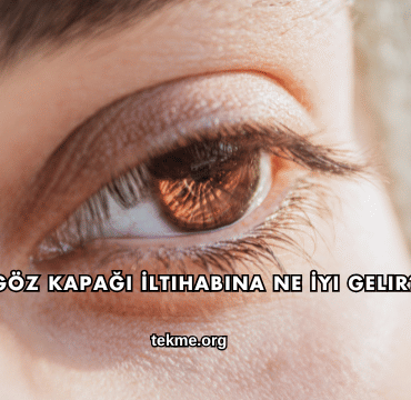 Göz Kapağı İltihabına Ne İyi Gelir?