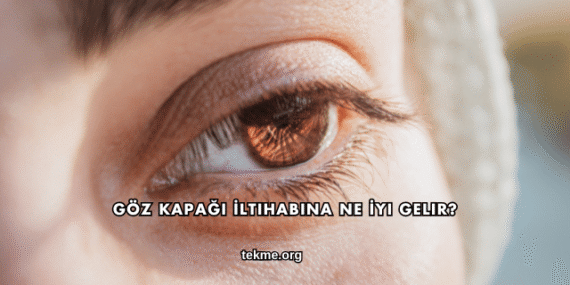 Göz Kapağı İltihabına Ne İyi Gelir?
