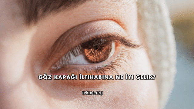 Göz Kapağı İltihabına Ne İyi Gelir?
