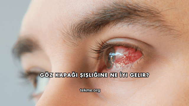 Göz Kapağı Şişliğine Ne İyi Gelir?