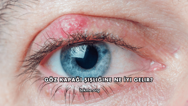 Göz Kapağı Şişliğine Ne İyi Gelir?