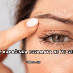 Göz Kapağında Egzamaya Ne İyi Gelir?