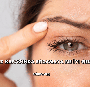 Göz Kapağında Egzamaya Ne İyi Gelir?