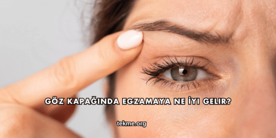 Göz Kapağında Egzamaya Ne İyi Gelir?