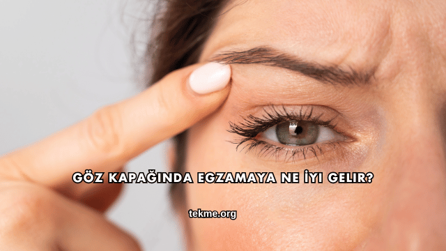 Göz Kapağında Egzamaya Ne İyi Gelir?