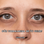 Göz Torbalarına Ne İyi Gelir?