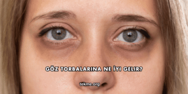 Göz Torbalarına Ne İyi Gelir?