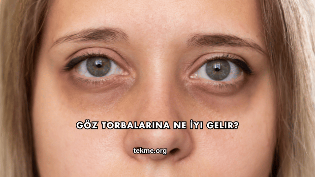 Göz Torbalarına Ne İyi Gelir?