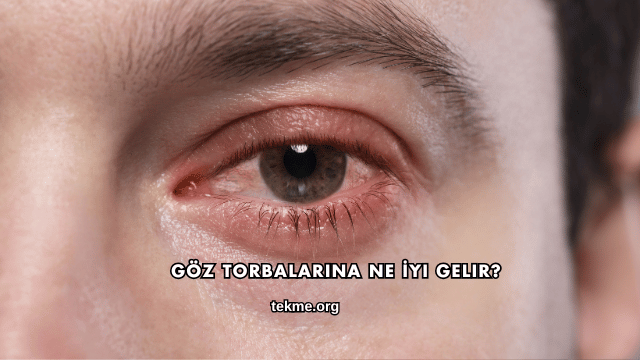 Göz Torbalarına Ne İyi Gelir?