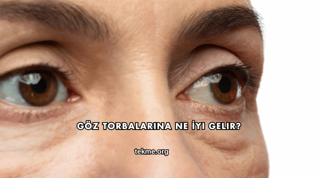 Göz Torbalarına Ne İyi Gelir?