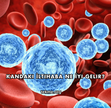 Kandaki İltihaba Ne İyi Gelir?