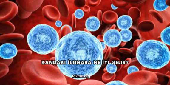 Kandaki İltihaba Ne İyi Gelir?