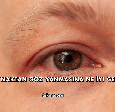 Kaynaktan Göz Yanmasına Ne İyi Gelir?