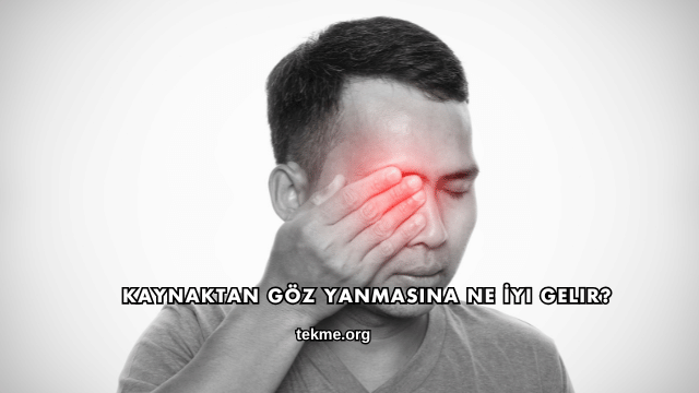 Kaynaktan Göz Yanmasına Ne İyi Gelir?