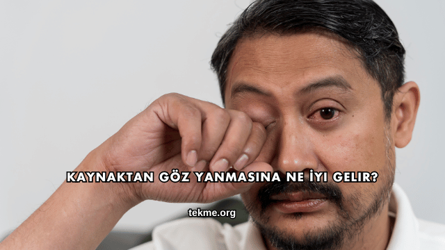 Kaynaktan Göz Yanmasına Ne İyi Gelir?