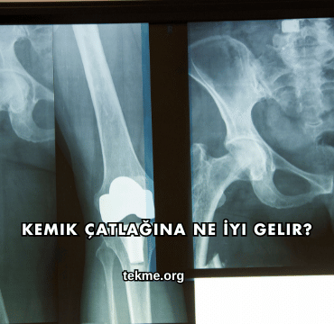 Kemik Çatlağına Ne İyi Gelir?