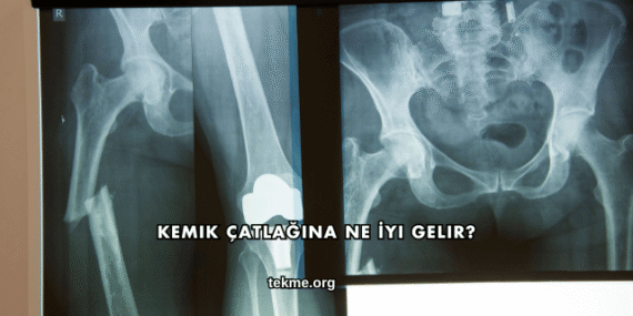 Kemik Çatlağına Ne İyi Gelir?