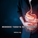 Midedeki Yaraya Ne İyi Gelir?