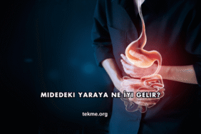 Midedeki Yaraya Ne İyi Gelir?