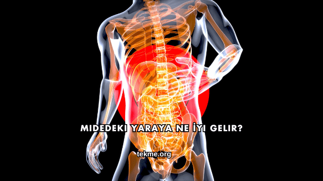 Midedeki Yaraya Ne İyi Gelir?