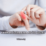 Parmak İltihabına Ne İyi Gelir?