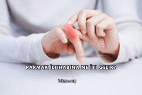 Parmak İltihabına Ne İyi Gelir?