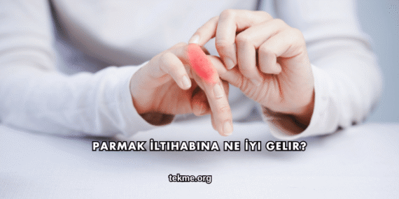 Parmak İltihabına Ne İyi Gelir?