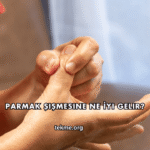 Parmak Şişmesine Ne İyi Gelir?