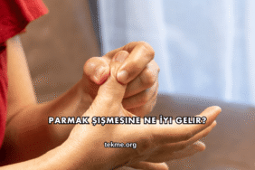 Parmak Şişmesine Ne İyi Gelir?