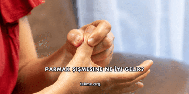 Parmak Şişmesine Ne İyi Gelir?