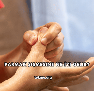 Parmak Şişmesine Ne İyi Gelir?